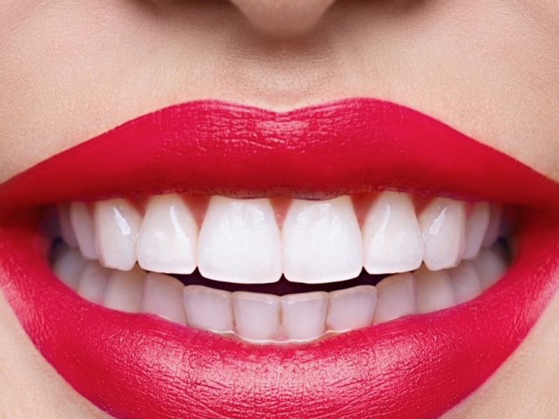 Mobile Teeth Whitening Business For Sale